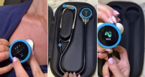 El estetoscopio con IA que Podría Salvar millones de Vidas a Través de un Análisis en 15 Segundos