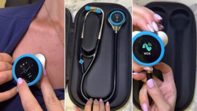 El estetoscopio con IA que Podría Salvar millones de Vidas a Través de un Análisis en 15 Segundos