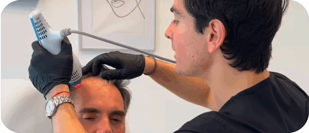 MyHair AI para detectar calvicie: origen de la idea y problema que quiere resolver