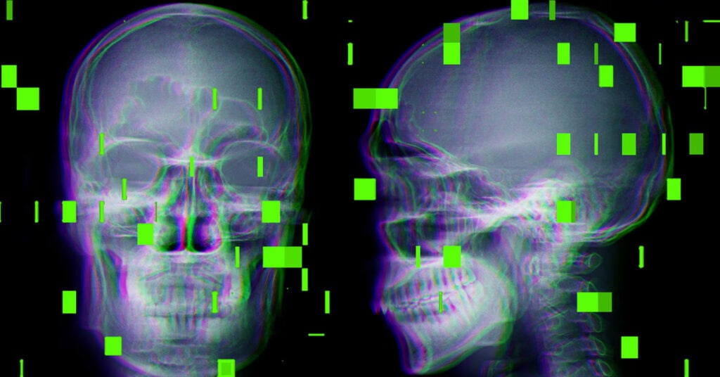 El caso TruDi: cuando la “navegación” se convierte en desorientación