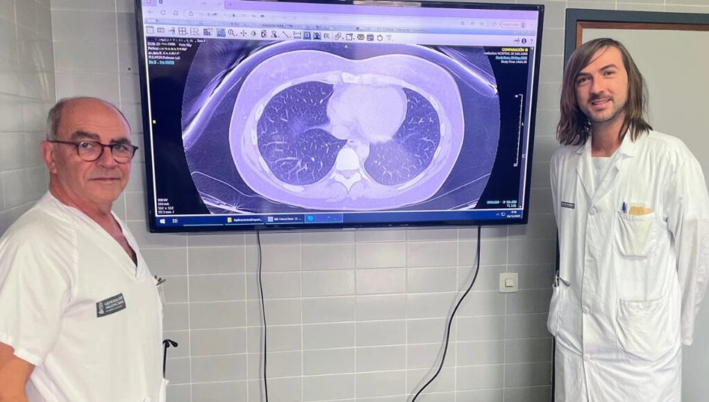 Hospital-Sant-Joan-dAlacant-Desarrolla-una-IA-para-Predecir-Respuesta-a-Tratamiento-Biologico-en-Asma-Grave