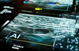 BMJ Open Revela Riesgos Graves de ChatGPT y Gemini en Consejos sobre Cáncer