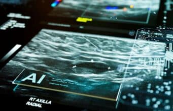 BMJ Open Revela Riesgos Graves de ChatGPT y Gemini al Proporcionar Consejos sobre Cáncer BMJ Open Revela Riesgos Graves de ChatGPT y Gemini en Consejos sobre Cáncer