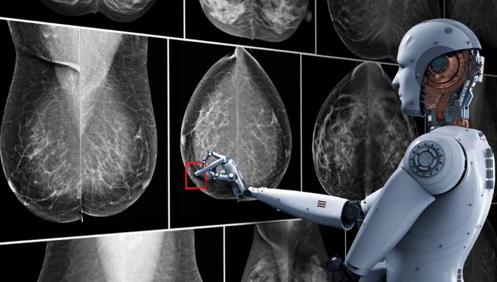 La Comunidad de Madrid Implanta IA para Detectar Antes el Cáncer de Mama y Próstata La Comunidad de Madrid Implanta IA para Detectar Antes el Cáncer de Mama y Próstata