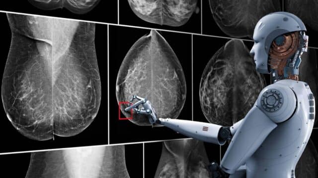 La Comunidad de Madrid Implanta IA para Detectar Antes el Cáncer de Mama y Próstata