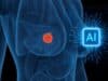 Harvard Revela Que la Inteligencia Artificial Detecta Cáncer de Mama Hasta 6 Años Antes de que Aparezca