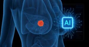 Harvard Revela Que la Inteligencia Artificial Detecta Cáncer de Mama Hasta 6 Años Antes de que Aparezca