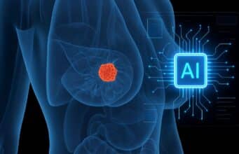 Harvard Revela Que la Inteligencia Artificial Detecta Cáncer de Mama Hasta 6 Años Antes de que Aparezca Harvard Revela Que la Inteligencia Artificial Detecta Cáncer de Mama Hasta 6 Años Antes de que Aparezca