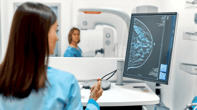 Los números del estudio demuestran que la IA anticipa el cáncer de forma masiva