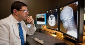 La IA Optimiza la Lectura de una Imagen Médica, Pero un Error Puede Ocultar una Hemorragia Cerebral