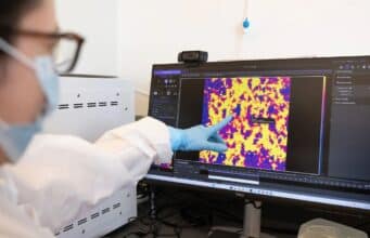 Amazon Acaba de Incorporar a AWS una IA que Utiliza Cerebros Reales Para Aprender Amazon Acaba de Incorporar a AWS una IA que Utiliza Cerebros Reales Para Aprender