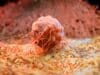 La IA de Plymouth Encuentra Señales del Cáncer de Vejiga Hasta Cinco Años Antes La IA de Plymouth Encuentra Señales del Cáncer de Vejiga Hasta Cinco Años Antes